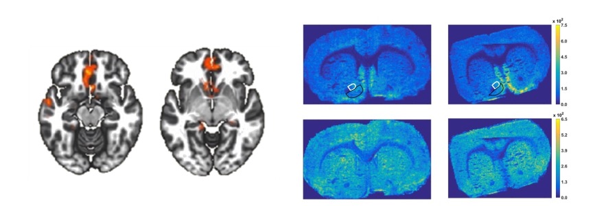 Brain scans of human and animal models showing effects of adolescent nicotine exposure.